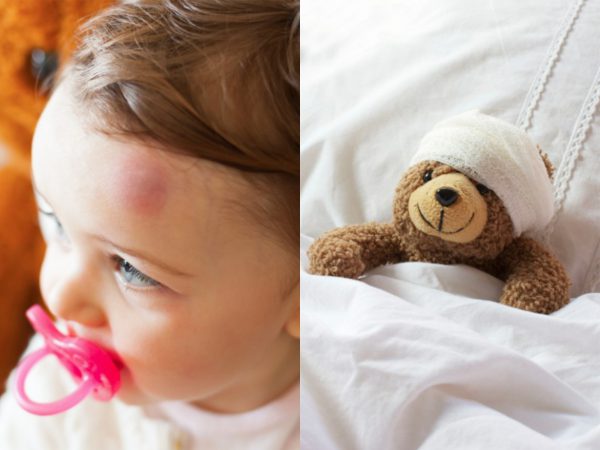 What to do when your kid hits their head